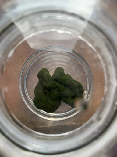 Vision